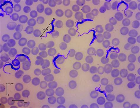  Trypanosoma - En mikroskopisk parasit som lever ett liv fullt av intrig och överlevnadsstrategier!